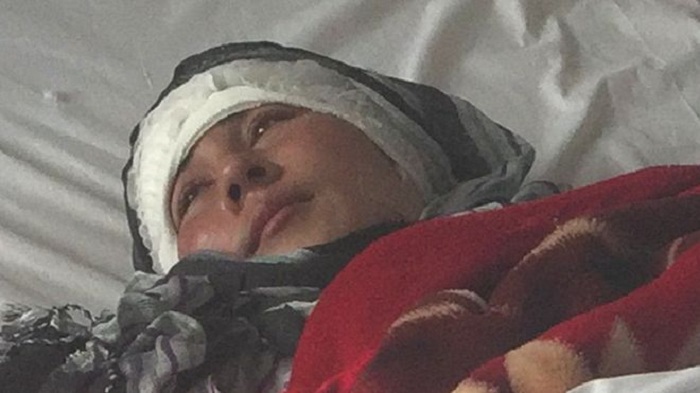 Afghan woman`s ears cut off by husband